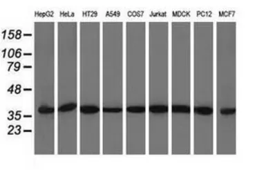 Anti-ACAT2 antibody [1C5] used in Western Blot (WB). GTX84977
