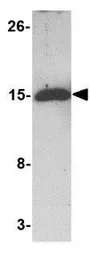 Anti-Bim antibody [1C2H4] used in Western Blot (WB). GTX84980