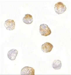 Anti-Bim antibody [1C2C8] used in Immunocytochemistry/ Immunofluorescence (ICC/IF). GTX84981