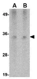 Anti-Hax1a antibody [9G6C6] used in Western Blot (WB). GTX84982