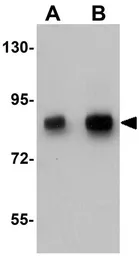 Anti-TCF12 antibody used in Western Blot (WB). GTX84997