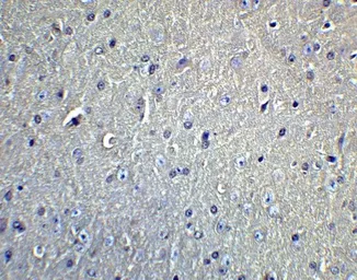 Anti-DCLK1 antibody used in IHC (Paraffin sections) (IHC-P). GTX85008