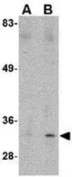 Anti-MARCH8 antibody used in Western Blot (WB). GTX85022