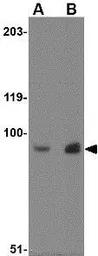 Anti-MEX3D antibody used in Western Blot (WB). GTX85026