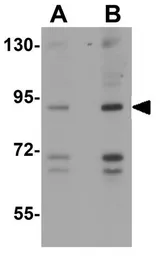 Anti-GPAM antibody used in Western Blot (WB). GTX85034