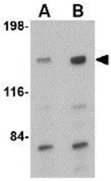 Anti-CAPS1 antibody used in Western Blot (WB). GTX85037