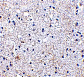 Anti-SCO1 antibody used in IHC (Paraffin sections) (IHC-P). GTX85056