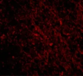 Anti-SCO1 antibody used in IHC (Paraffin sections) (IHC-P). GTX85056