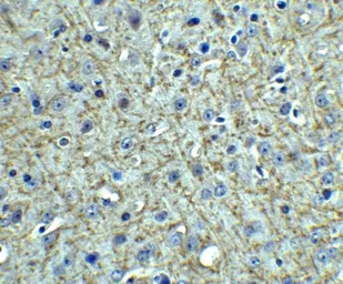 Anti-TSLP antibody used in IHC (Paraffin sections) (IHC-P). GTX85059