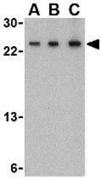 Anti-TSLP antibody used in Western Blot (WB). GTX85059