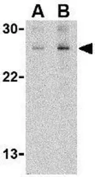 Anti-TSLP antibody used in Western Blot (WB). GTX85060