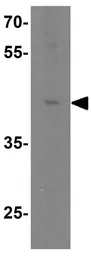 Anti-TIM-1 antibody used in Western Blot (WB). GTX85068