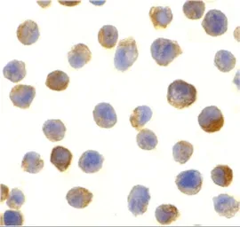 Anti-CTRP2 antibody used in Immunocytochemistry/ Immunofluorescence (ICC/IF). GTX85071