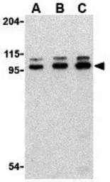 Anti-TLR6 antibody used in Western Blot (WB). GTX85074