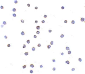 Anti-TLR6 antibody used in Immunocytochemistry/ Immunofluorescence (ICC/IF). GTX85074