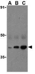 Anti-ECSIT antibody used in Western Blot (WB). GTX85081