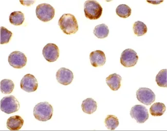 Anti-DAD1 antibody used in Immunocytochemistry/ Immunofluorescence (ICC/IF). GTX85083