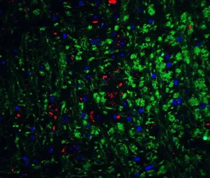 Anti-Neurturin antibody used in IHC (Paraffin sections) (IHC-P). GTX85089