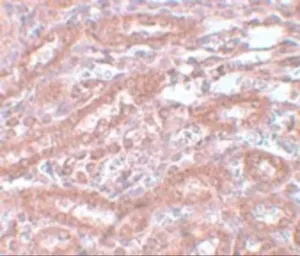 Anti-ENC1 antibody used in IHC (Paraffin sections) (IHC-P). GTX85108