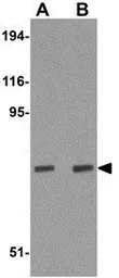 Anti-LDL Receptor antibody used in Western Blot (WB). GTX85109