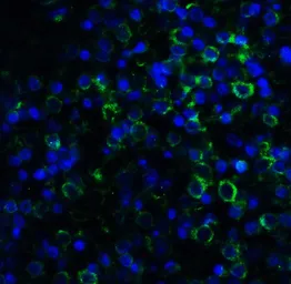 Anti-MD2 antibody [1A2E3] used in IHC (Paraffin sections) (IHC-P). GTX85121