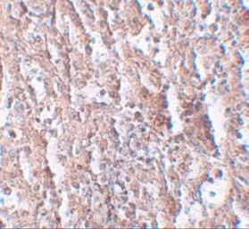Anti-ZIP5 antibody used in IHC (Paraffin sections) (IHC-P). GTX85132