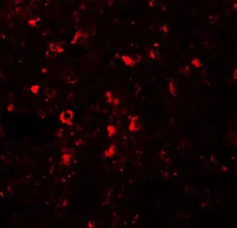 Anti-ZIP5 antibody used in IHC (Paraffin sections) (IHC-P). GTX85132