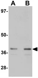 Anti-ZIP1 antibody used in Western Blot (WB). GTX85135
