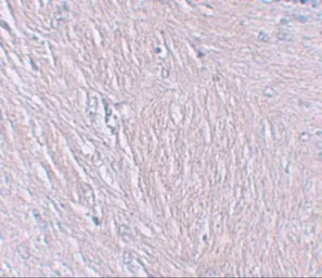 Anti-Synaptopodin antibody used in IHC (Paraffin sections) (IHC-P). GTX85140
