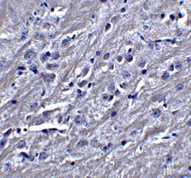 Anti-Synaptopodin antibody used in IHC (Paraffin sections) (IHC-P). GTX85140
