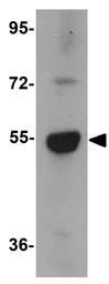 Anti-LMBRD1 antibody used in Western Blot (WB). GTX85141