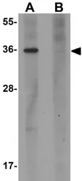 Anti-PLAC1 antibody used in Western Blot (WB). GTX85151