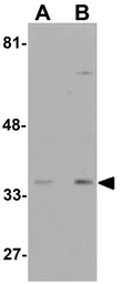 Anti-WDR92 antibody used in Western Blot (WB). GTX85162