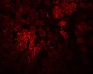 Anti-CCDC106 antibody used in IHC (Paraffin sections) (IHC-P). GTX85167