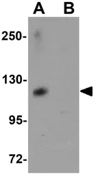 Anti-ATP11A antibody used in Western Blot (WB). GTX85170
