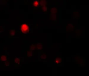Anti-TCTN3 antibody used in Immunocytochemistry/ Immunofluorescence (ICC/IF). GTX85175