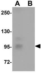 Anti-ZC3H12C antibody used in Western Blot (WB). GTX85195