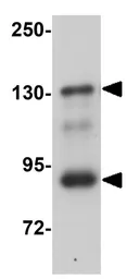 Anti-LZTR2 antibody used in Western Blot (WB). GTX85204