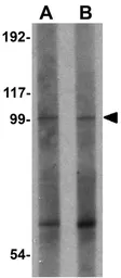 Anti-FRMPD2 antibody used in Western Blot (WB). GTX85236