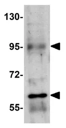 Anti-RUSC1 antibody used in Western Blot (WB). GTX85244