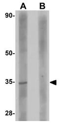 Anti-SKA2 antibody used in Western Blot (WB). GTX85247