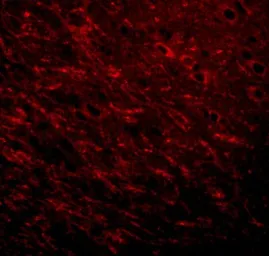 Anti-Prosapip1 antibody used in IHC (Paraffin sections) (IHC-P). GTX85249