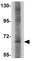 Anti-Prosapip1 antibody used in Western Blot (WB). GTX85249