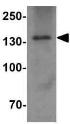 Anti-PALB2 antibody used in Western Blot (WB). GTX85263