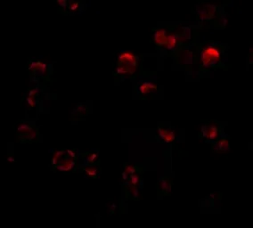 Anti-KLHL15 antibody used in Immunocytochemistry/ Immunofluorescence (ICC/IF). GTX85275