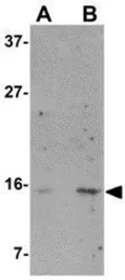 Anti-Norrin antibody used in Western Blot (WB). GTX85292