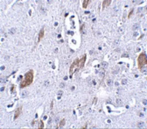 Anti-ATOH8 antibody used in IHC (Paraffin sections) (IHC-P). GTX85296