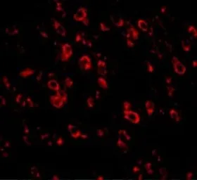 Anti-PCDH18 antibody used in IHC (Paraffin sections) (IHC-P). GTX85299