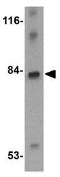 Anti-LRFN4 antibody used in Western Blot (WB). GTX85341