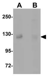 Anti-PCDH12 antibody used in Western Blot (WB). GTX85342